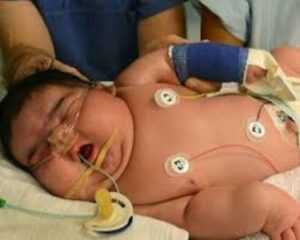 خطرات دیابت در بارداری که جنین را تحت تاثیر قرار می دهد.