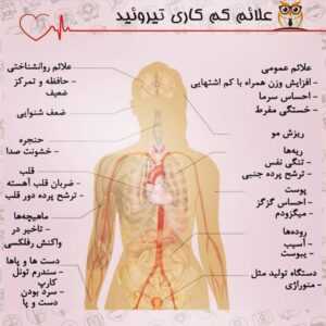 تیروئید کمکار