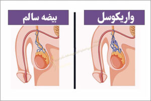 عوامل ناباروری مردان