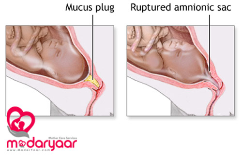 علائم شروع زایمان طبیعی