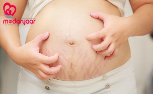 جوش و خارش در بارداری