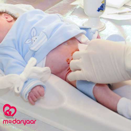 ختنه نوزاد پسر