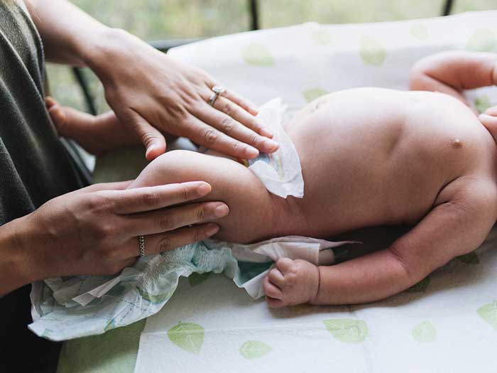 ختنه نوزاد پسر