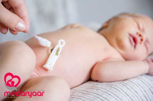 مراقبت از بند ناف نوزاد