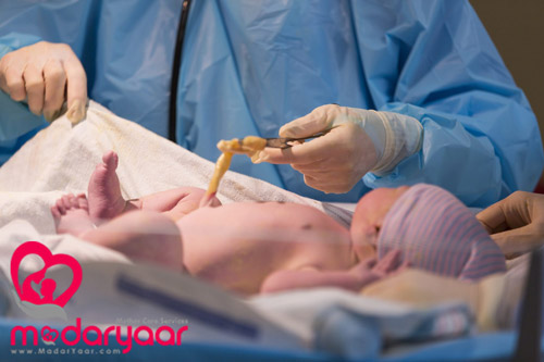 ذخیره خون بند ناف نوزاد