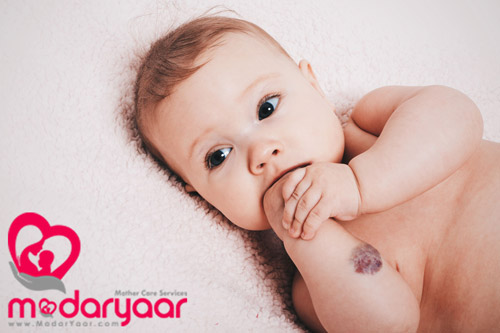 مراقبت از پوست نوزاد