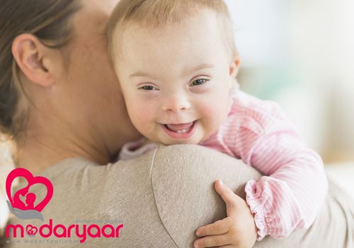 کودک سندروم داون